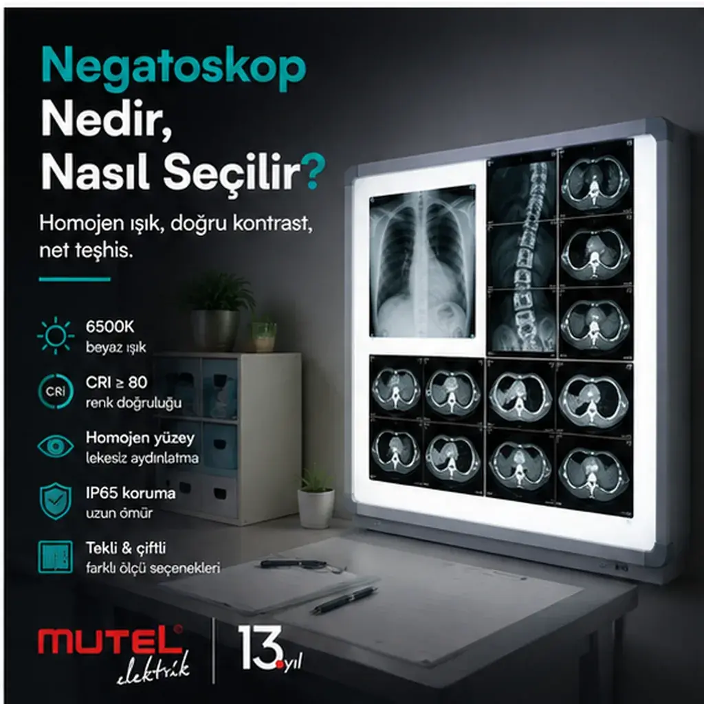 Negatoskop Nedir, Nasıl Seçilir? 